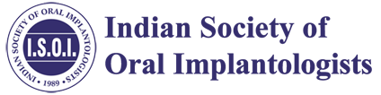 isoi implant